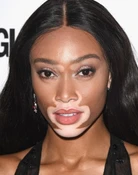 Winnie Harlow